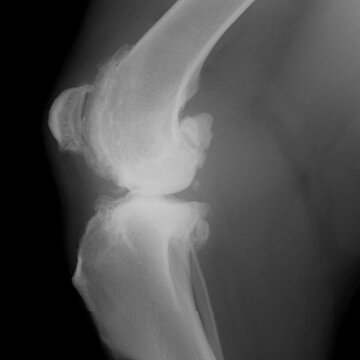 Kniegelenk eines Hundes mit Arthrose.