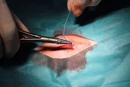 Intrakutane Hautnaht.