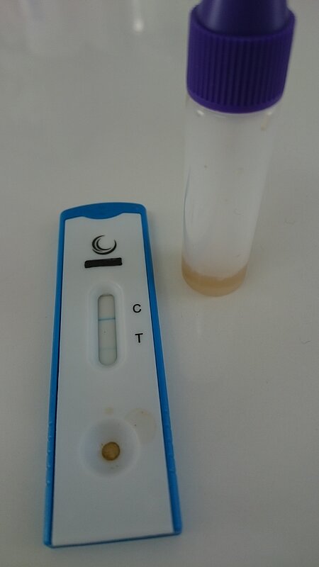 Giardientest